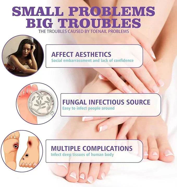 nail fungus spray