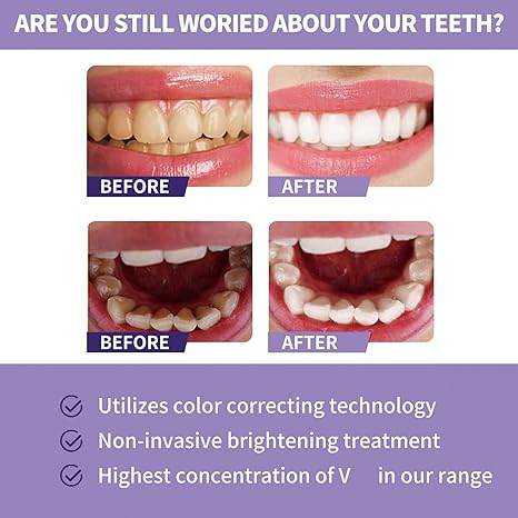 toothpaste for teeth whitening (30ml)